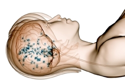 sleeping_brain_4yourhealth.gr_medical-catalog_iatrikos-katalogos