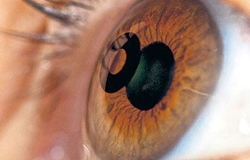 eye-mati-presviopia-4yourhealth.gr-anazitisi-giatron-αναζήτηση-γιατρών