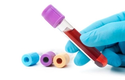 aimatologiko_test_arthritida