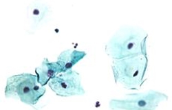 test-pap-eksetasi